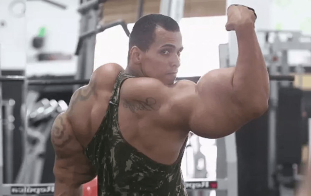 Video: 'The Synthol Kid' Gets 'Alien' Injections in Face, Refusing Doctor  Recommendations – Fitness Volt