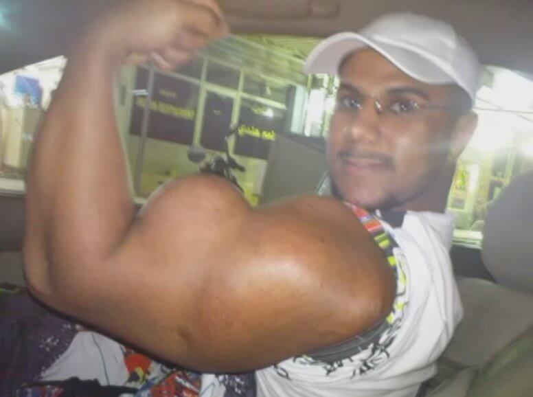 synthol-abuse (15)