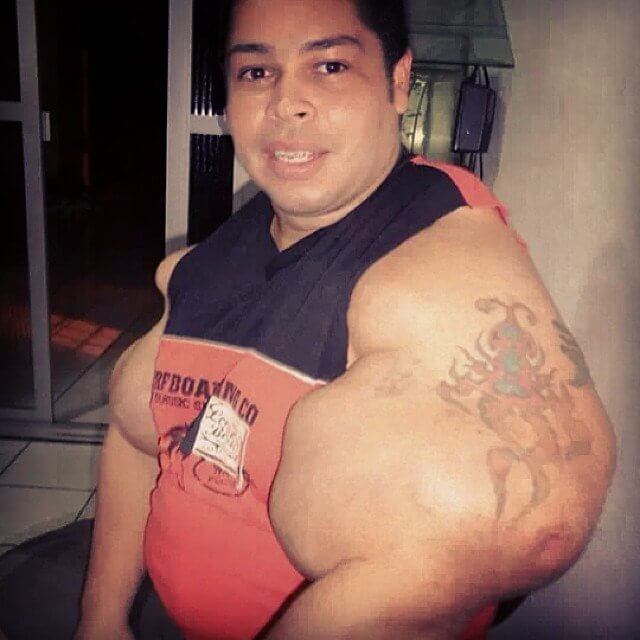 synthol-abuse (19)