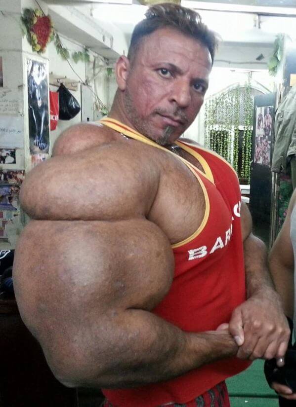 synthol-abuse (2)